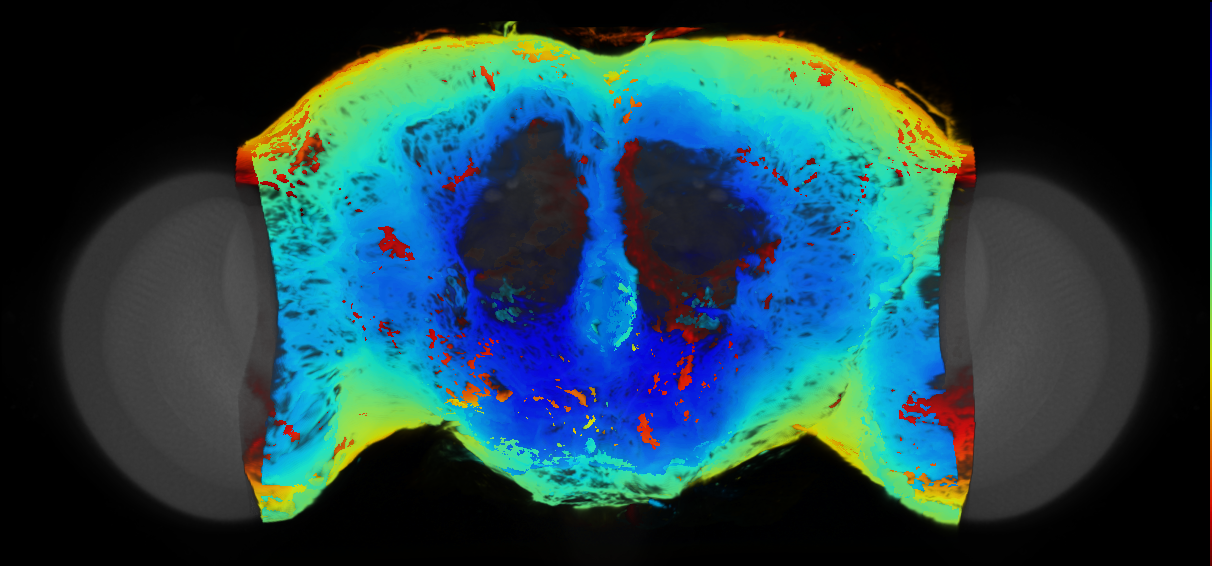 P{VT007764-GAL4} expression pattern