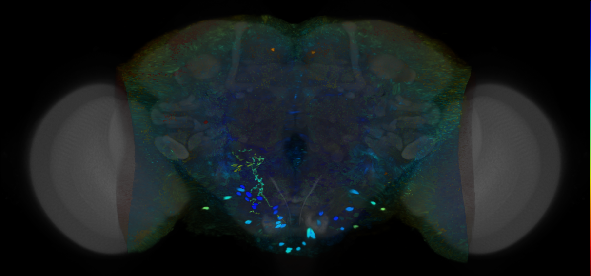 P{VT008271-GAL4} expression pattern