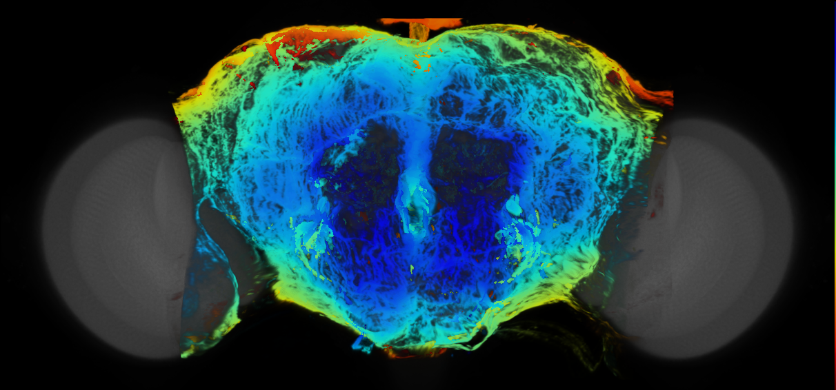 P{VT008537-GAL4} expression pattern