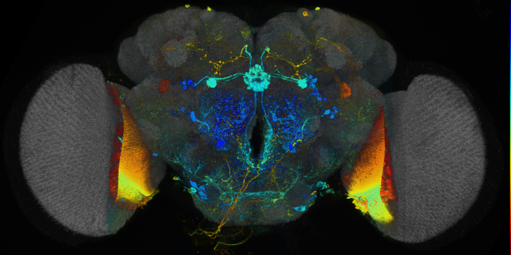 P{VT008665-GAL4} expression pattern