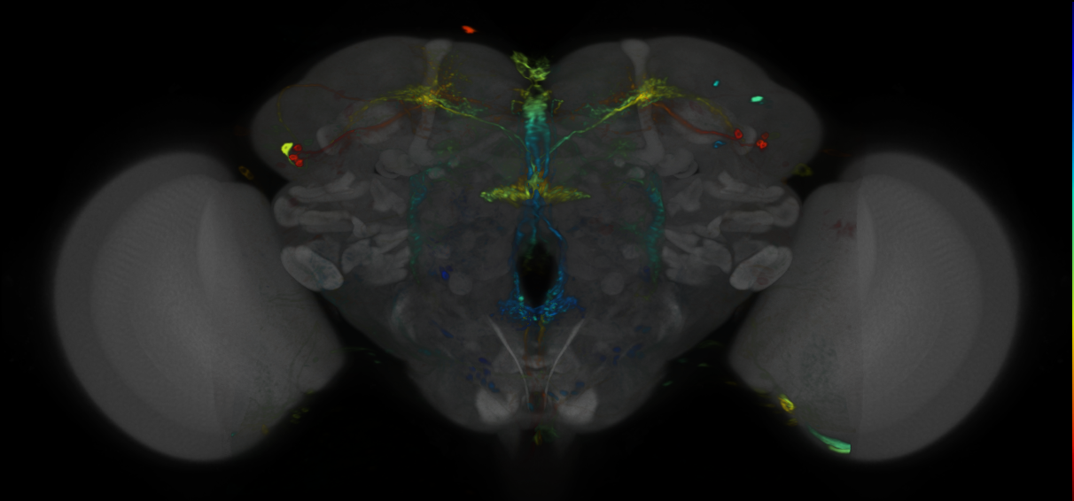 P{VT009834-GAL4} expression pattern