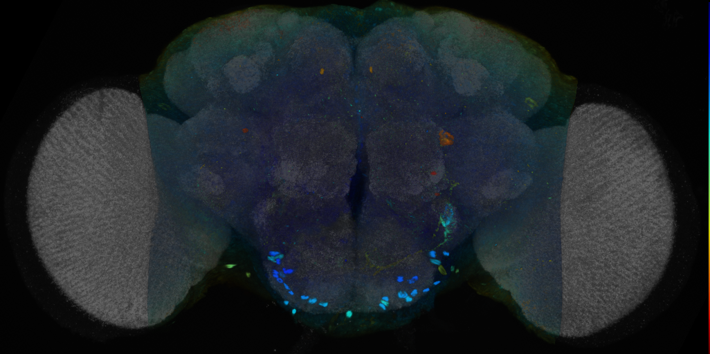 P{VT010001-GAL4} expression pattern