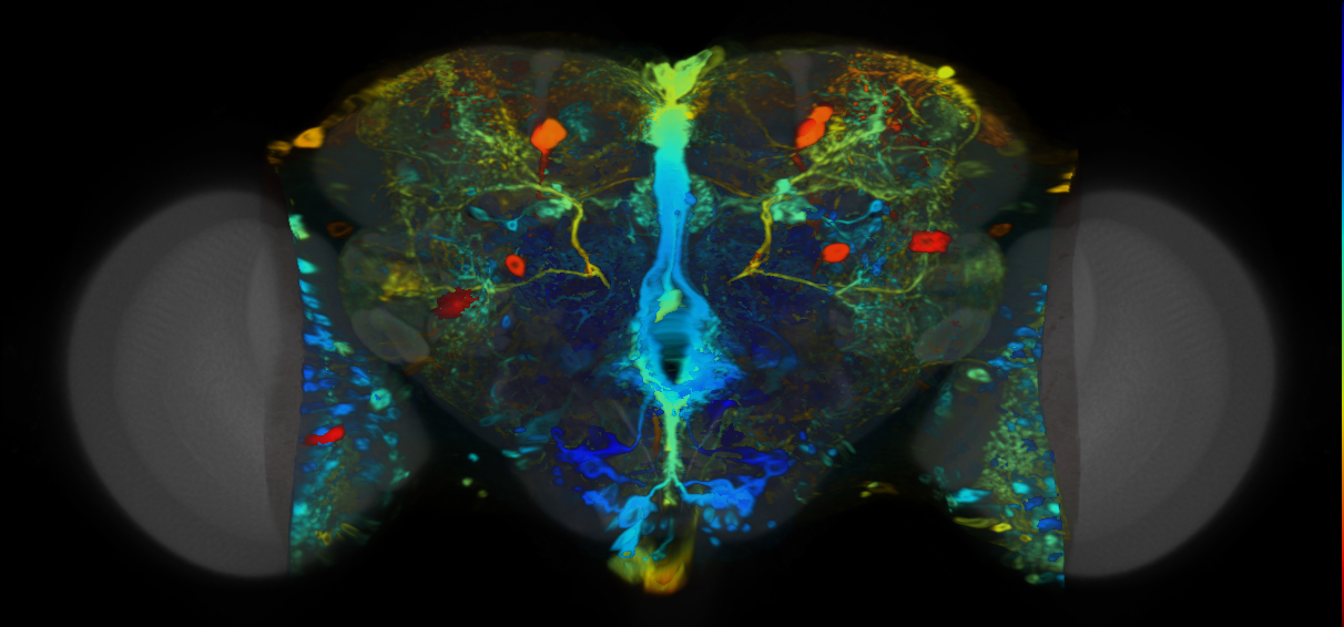 P{VT014966-GAL4} expression pattern