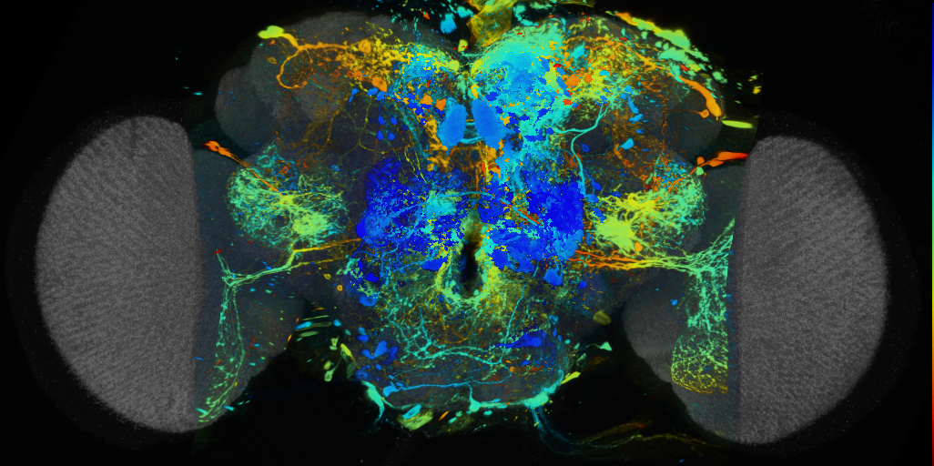 P{VT017123-GAL4} expression pattern