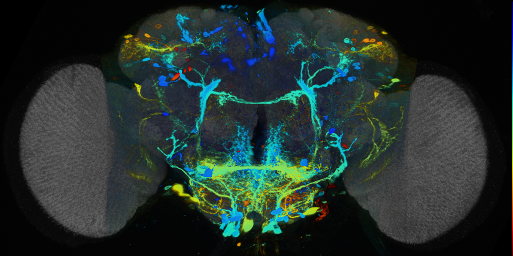P{VT017240-GAL4} expression pattern