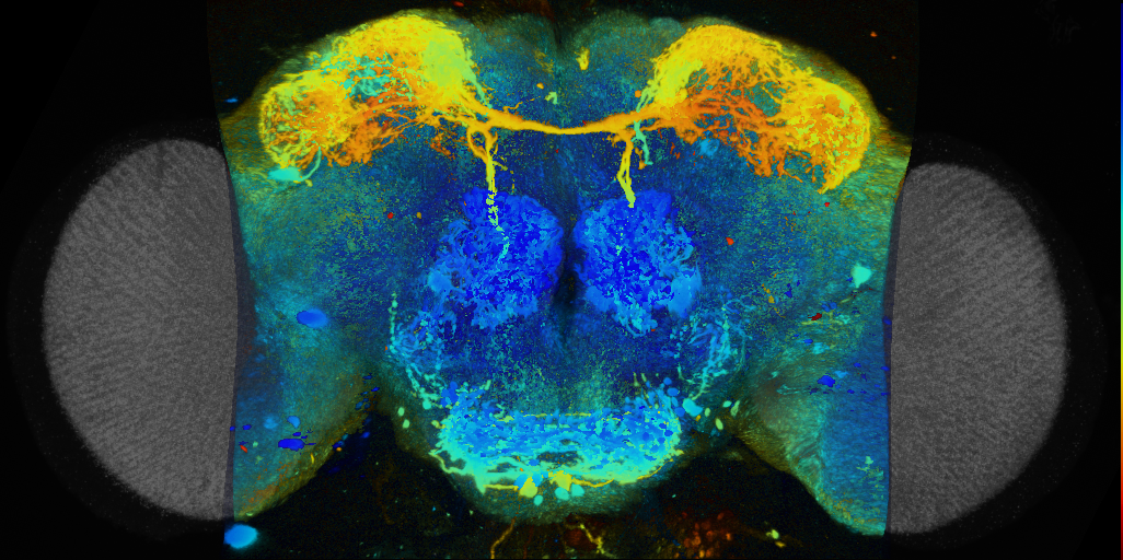 P{VT017862-GAL4} expression pattern
