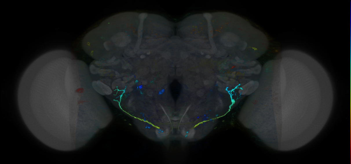 P{VT018473-GAL4} expression pattern