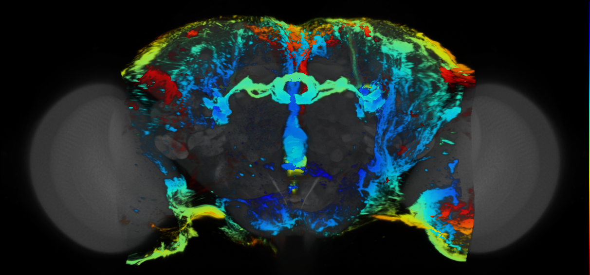 P{VT018776-GAL4} expression pattern