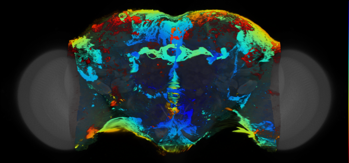 P{VT018776-GAL4} expression pattern