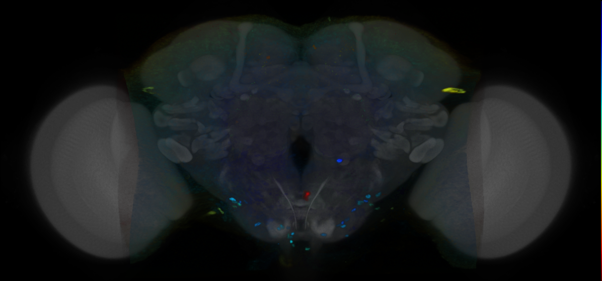 P{VT022985-GAL4} expression pattern