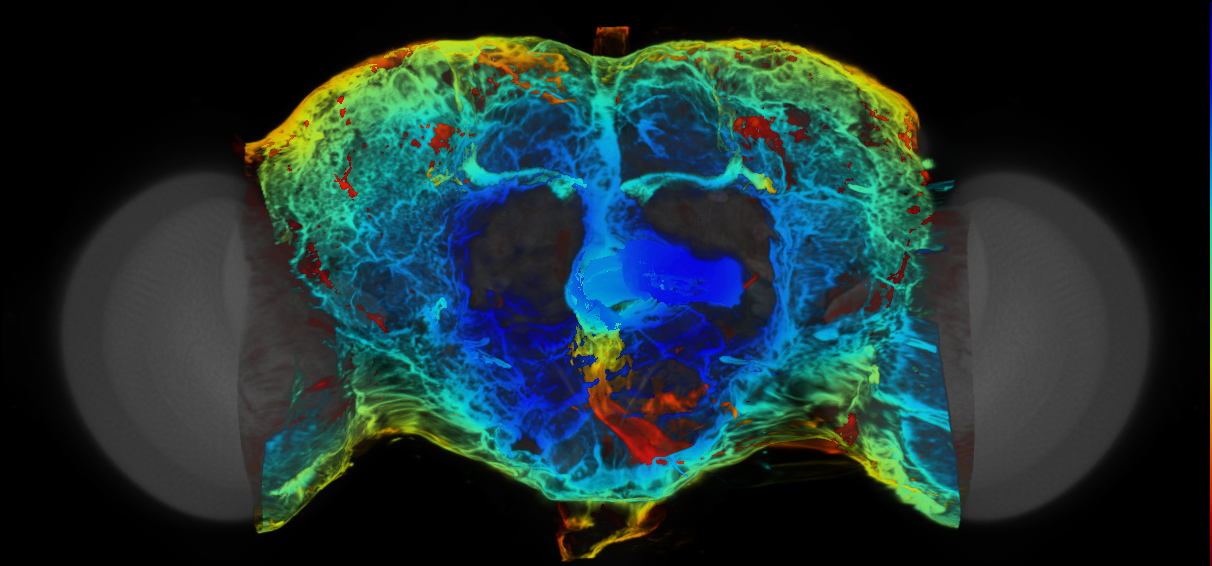 P{VT023564-GAL4} expression pattern