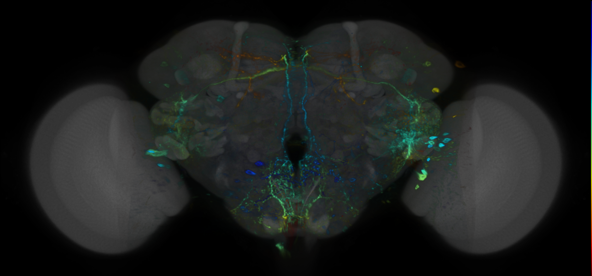 P{VT026034-GAL4} expression pattern
