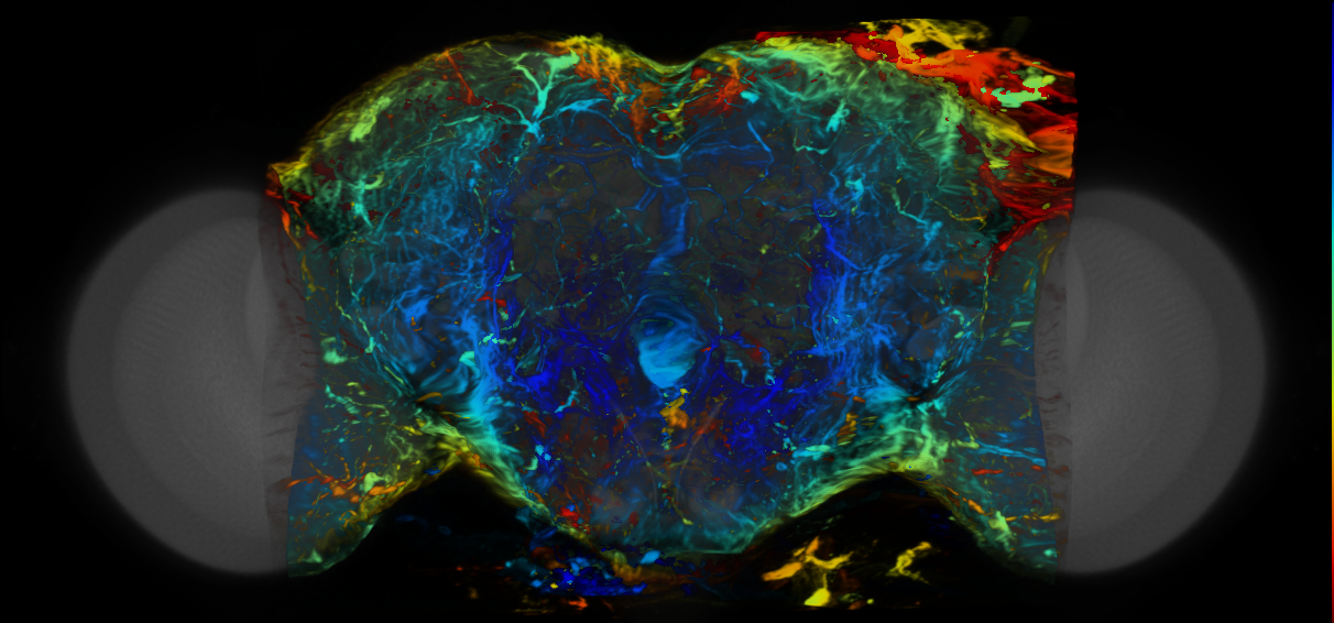 P{VT026136-GAL4} expression pattern