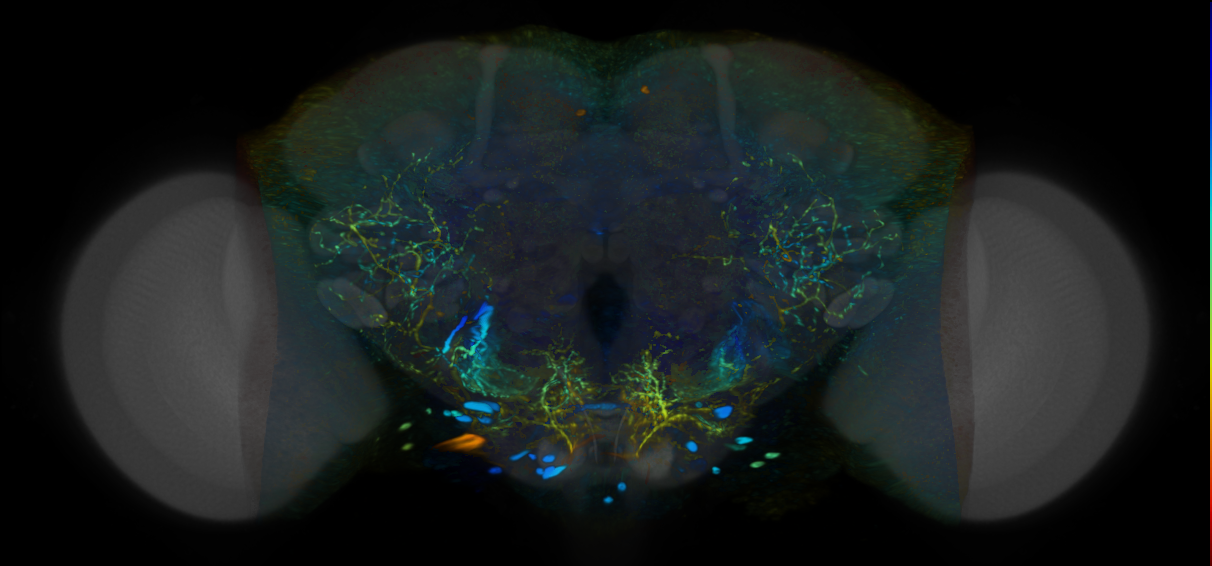 P{VT026389-GAL4} expression pattern