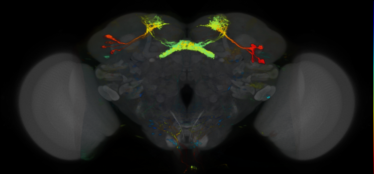 P{VT026663-GAL4} expression pattern