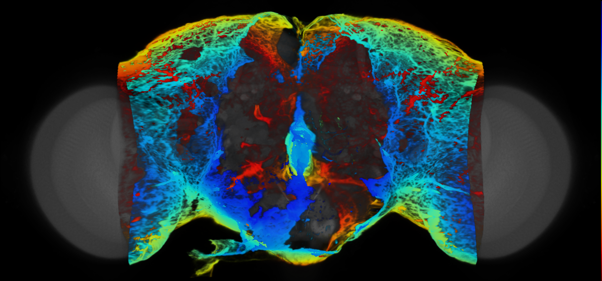 P{VT026747-GAL4} expression pattern