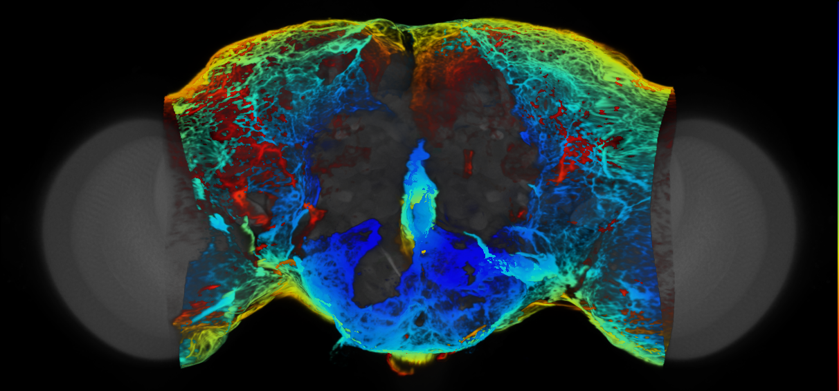 P{VT026747-GAL4} expression pattern