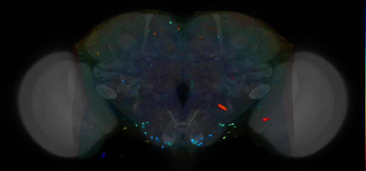 P{VT027194-GAL4} expression pattern