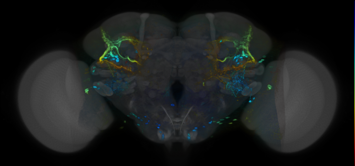 P{VT028144-GAL4} expression pattern