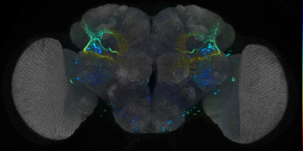 P{VT028144-GAL4} expression pattern