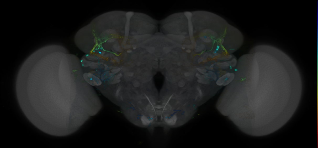 P{VT028144-GAL4} expression pattern
