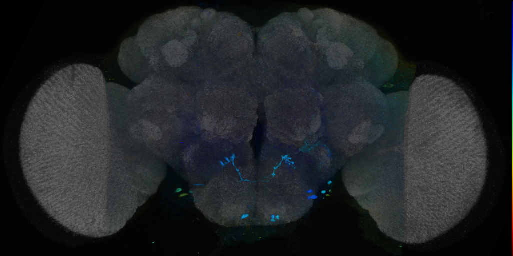 P{VT028599-GAL4} expression pattern