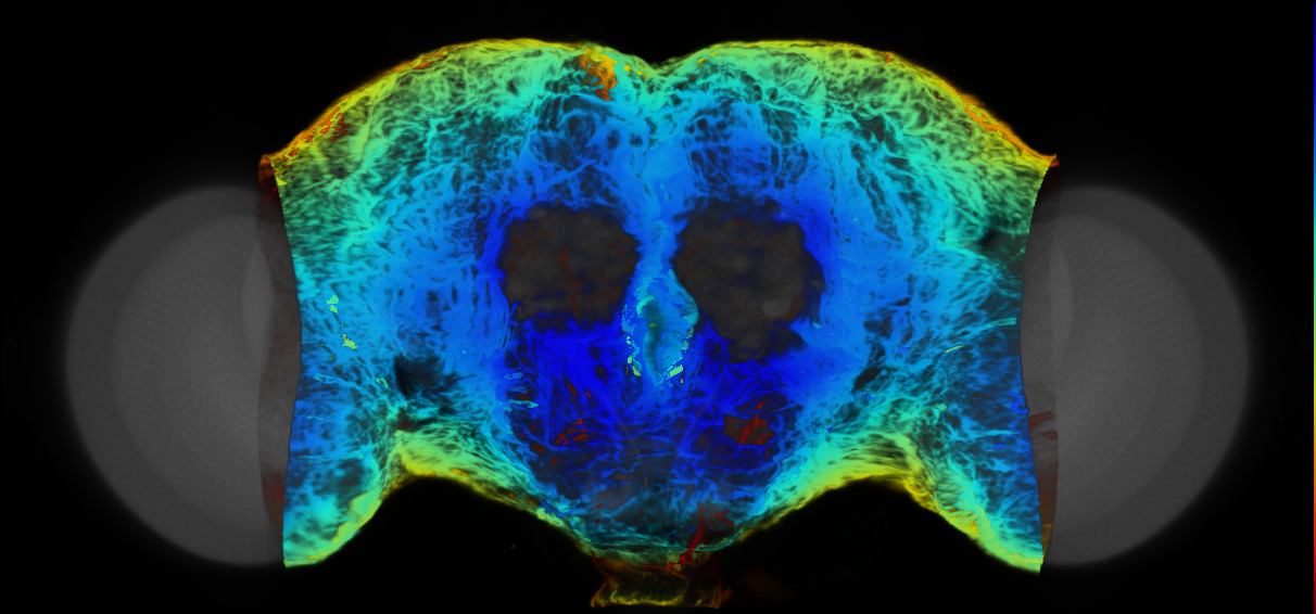 P{VT029200-GAL4} expression pattern