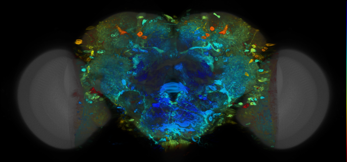 P{VT031169-GAL4} expression pattern