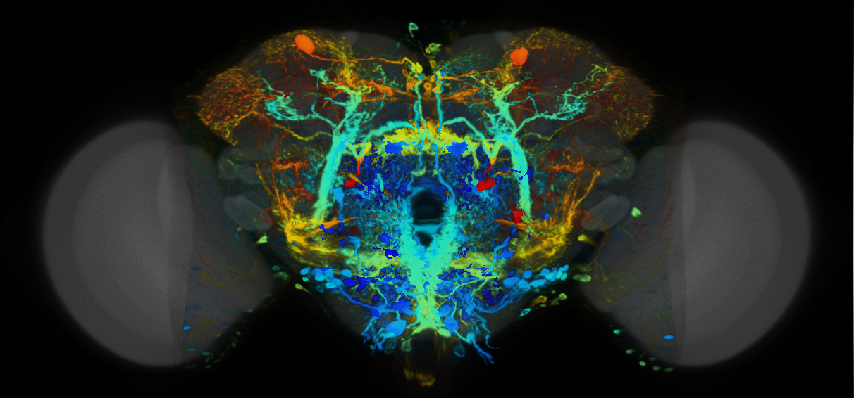 P{VT031176-GAL4} expression pattern