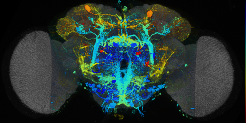P{VT031176-GAL4} expression pattern