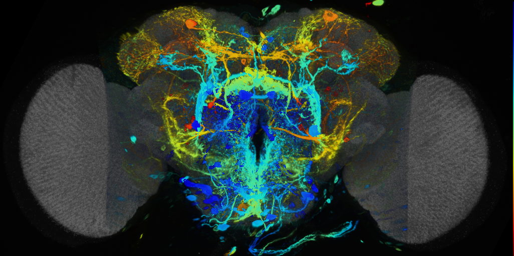 P{VT031176-GAL4} expression pattern