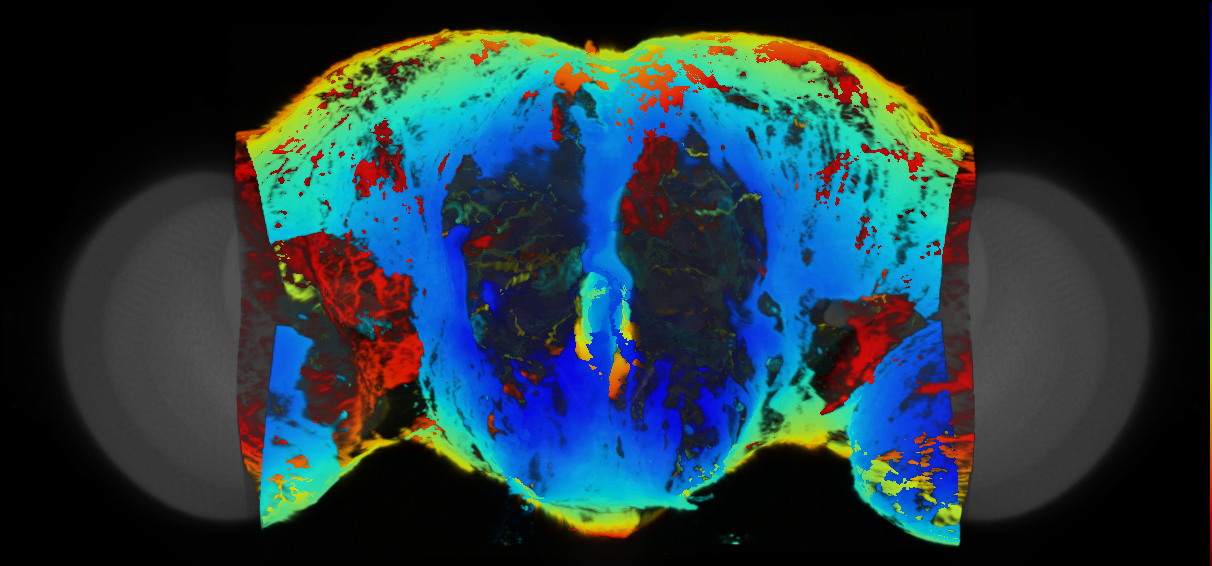 P{VT032049-GAL4} expression pattern