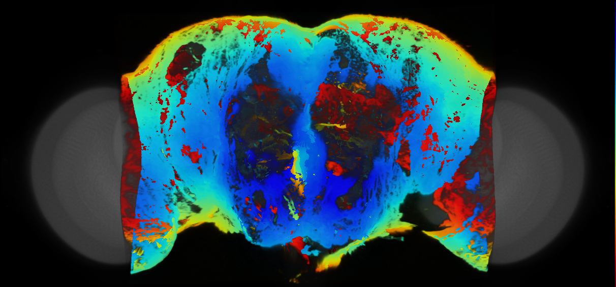 P{VT032049-GAL4} expression pattern