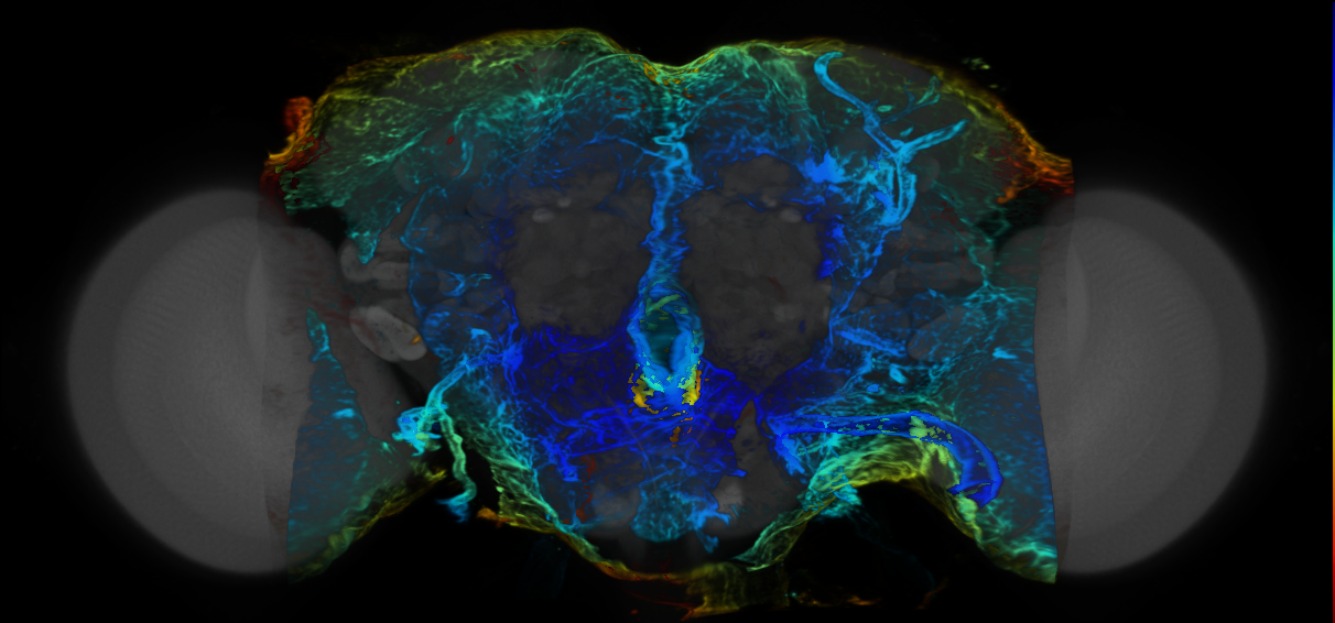 P{VT032966-GAL4} expression pattern