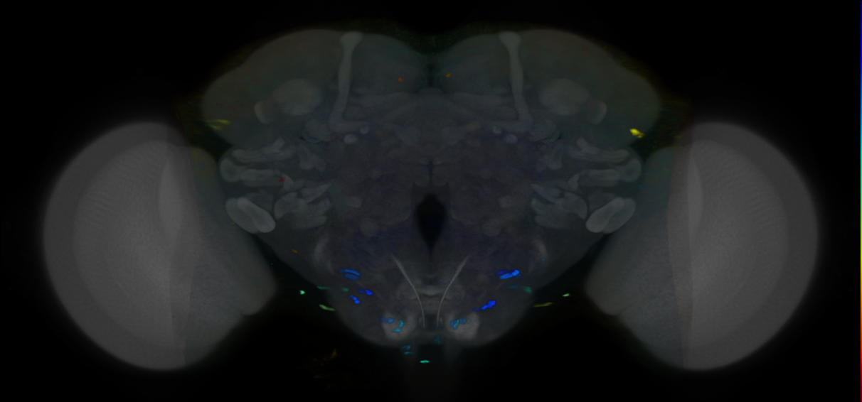 P{VT033237-GAL4} expression pattern