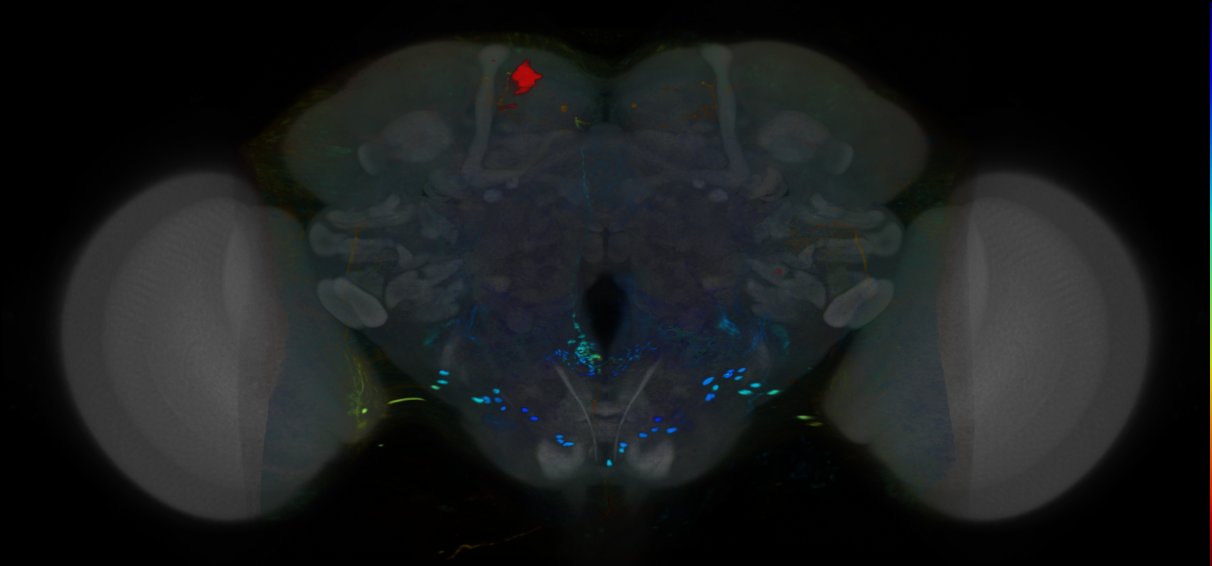 P{VT034392-GAL4} expression pattern