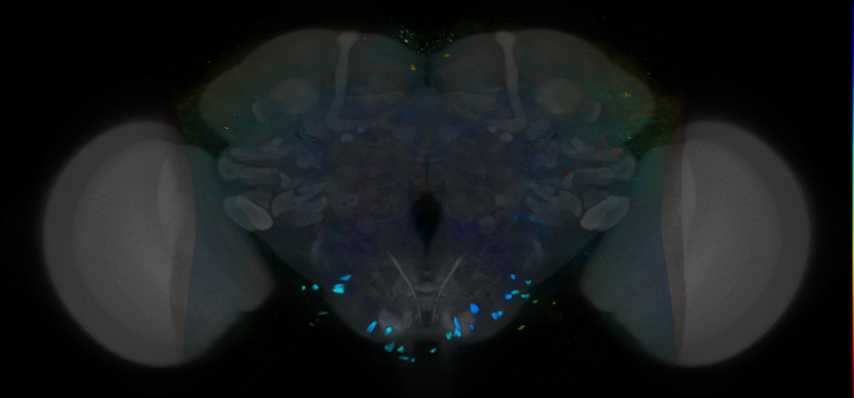 P{VT034399-GAL4} expression pattern