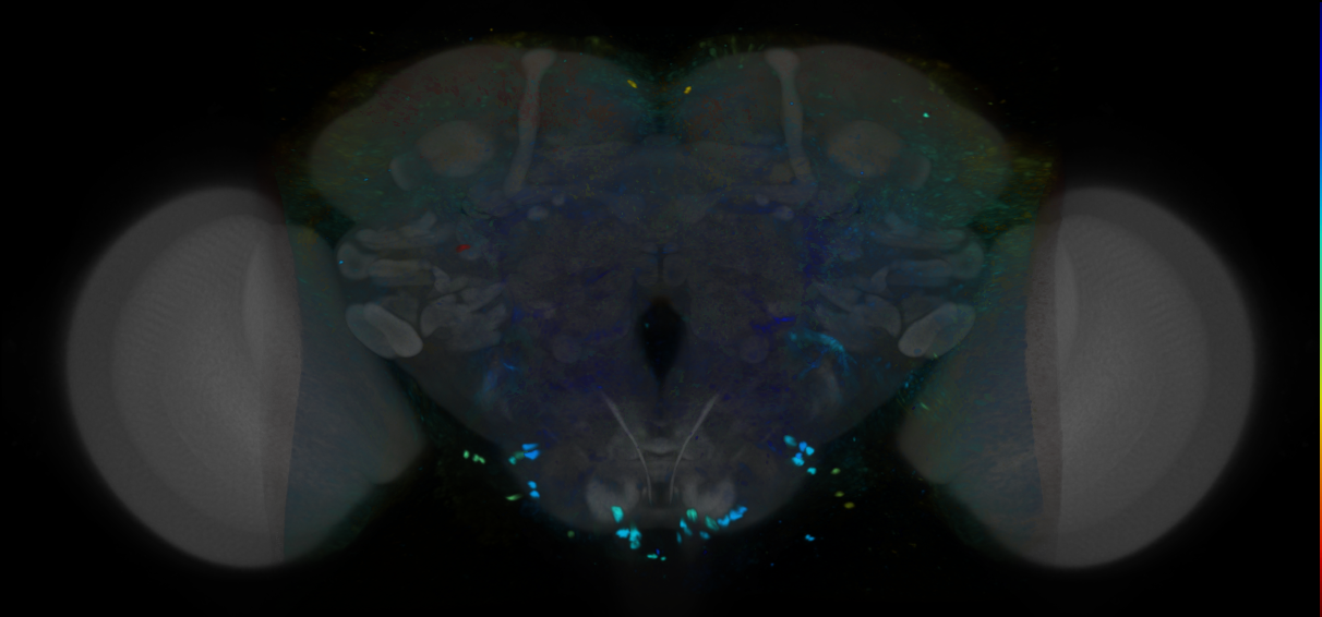 P{VT034399-GAL4} expression pattern