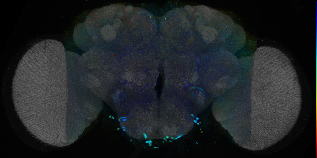 P{VT034399-GAL4} expression pattern