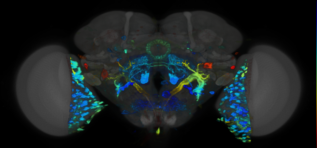 P{VT034615-GAL4} expression pattern
