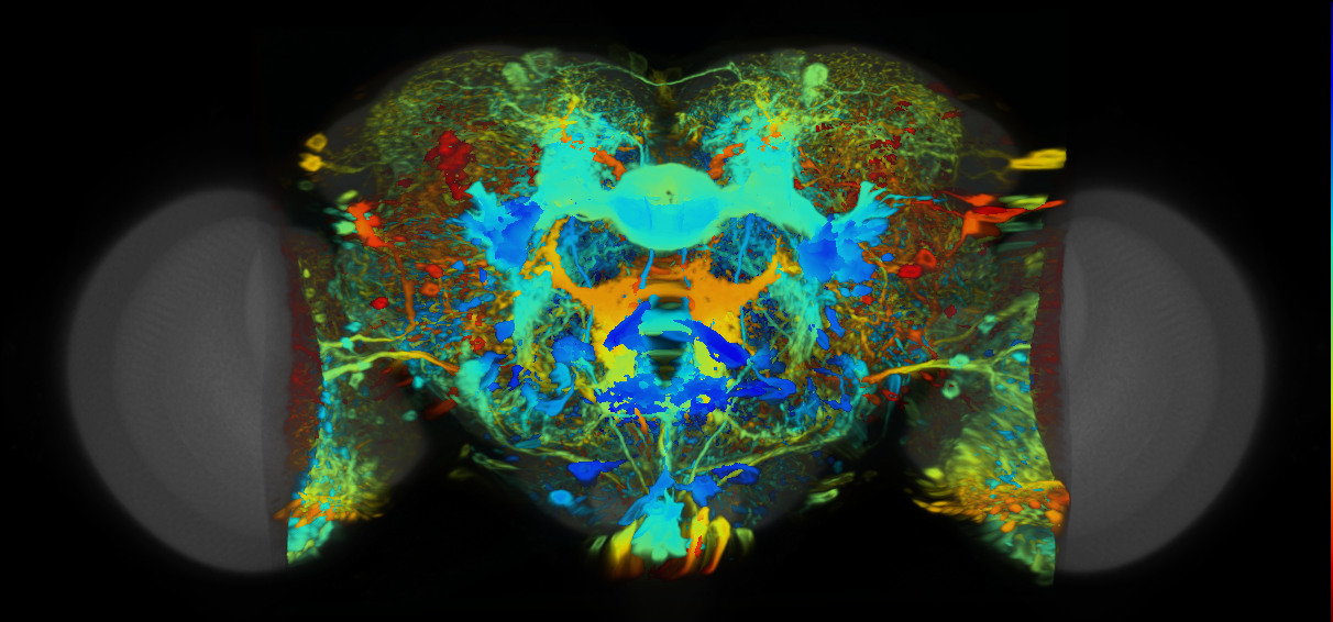 P{VT034815-GAL4} expression pattern