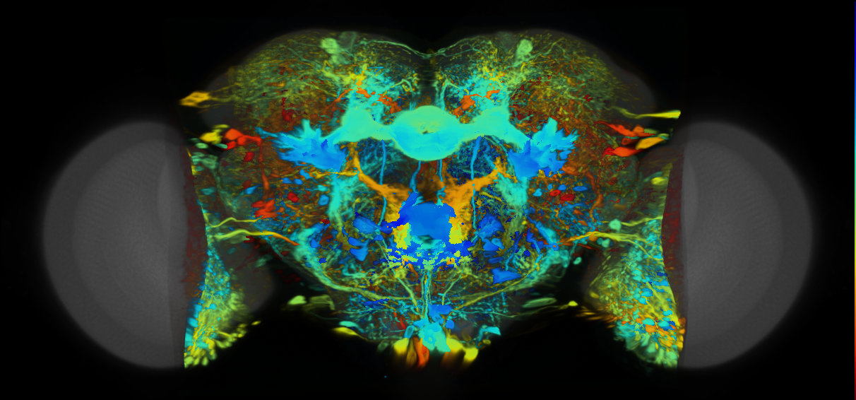 P{VT034815-GAL4} expression pattern