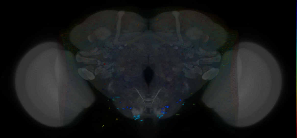 P{VT035184-GAL4} expression pattern