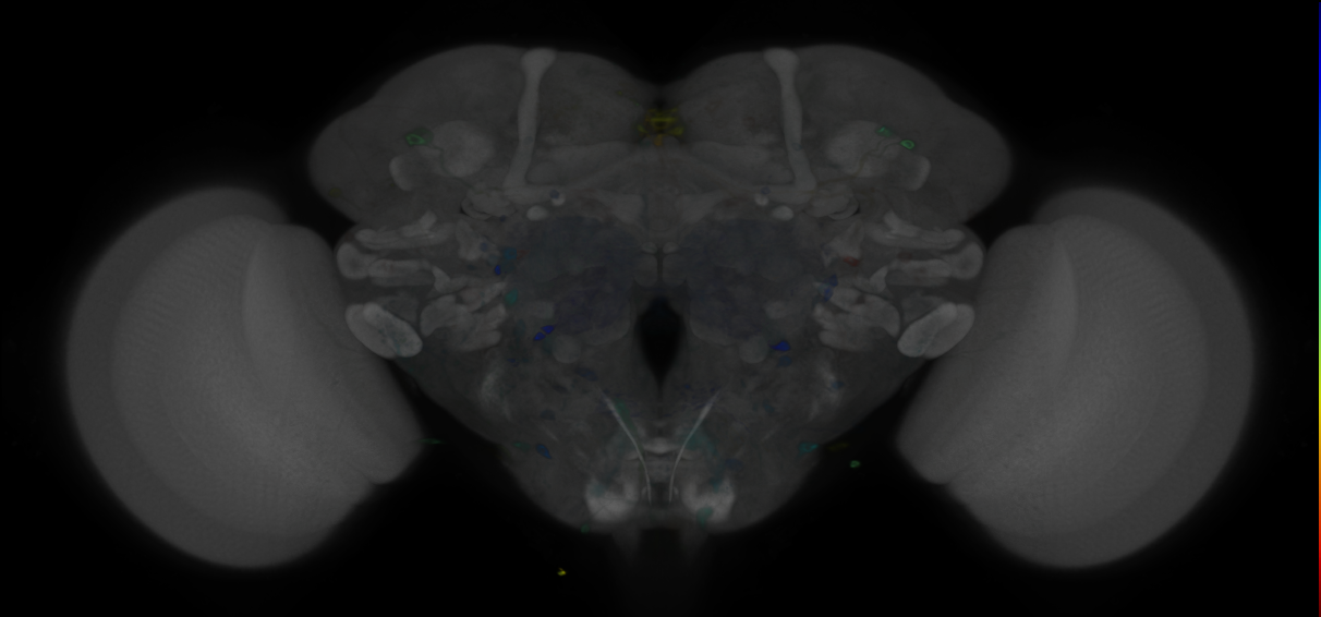P{VT036266-GAL4} expression pattern
