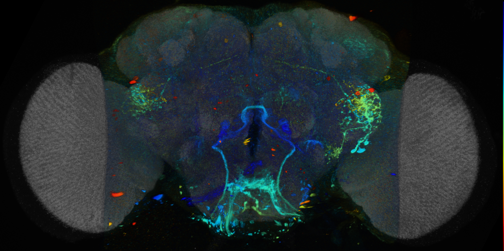 P{VT036276-GAL4} expression pattern