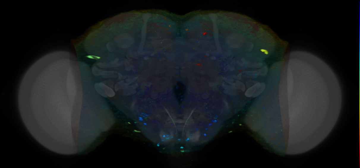 P{VT036304-GAL4} expression pattern