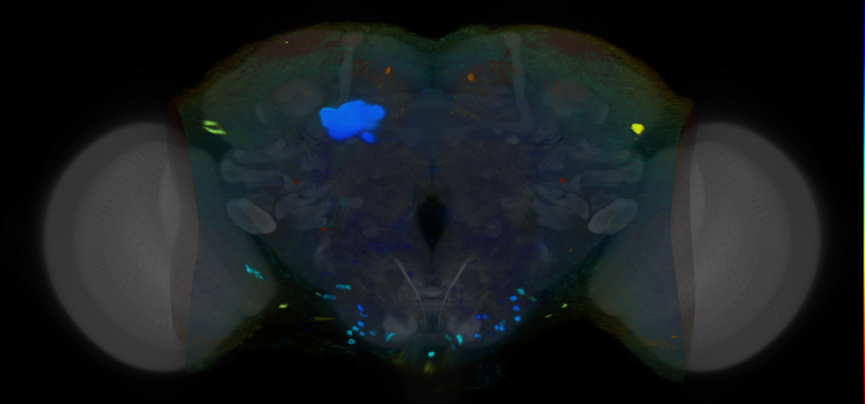 P{VT036304-GAL4} expression pattern