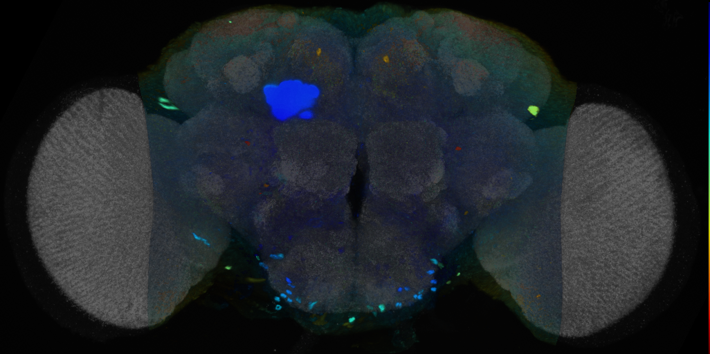 P{VT036304-GAL4} expression pattern