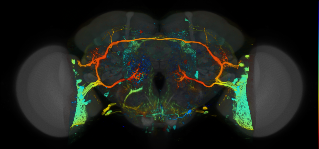 P{VT037867-GAL4} expression pattern
