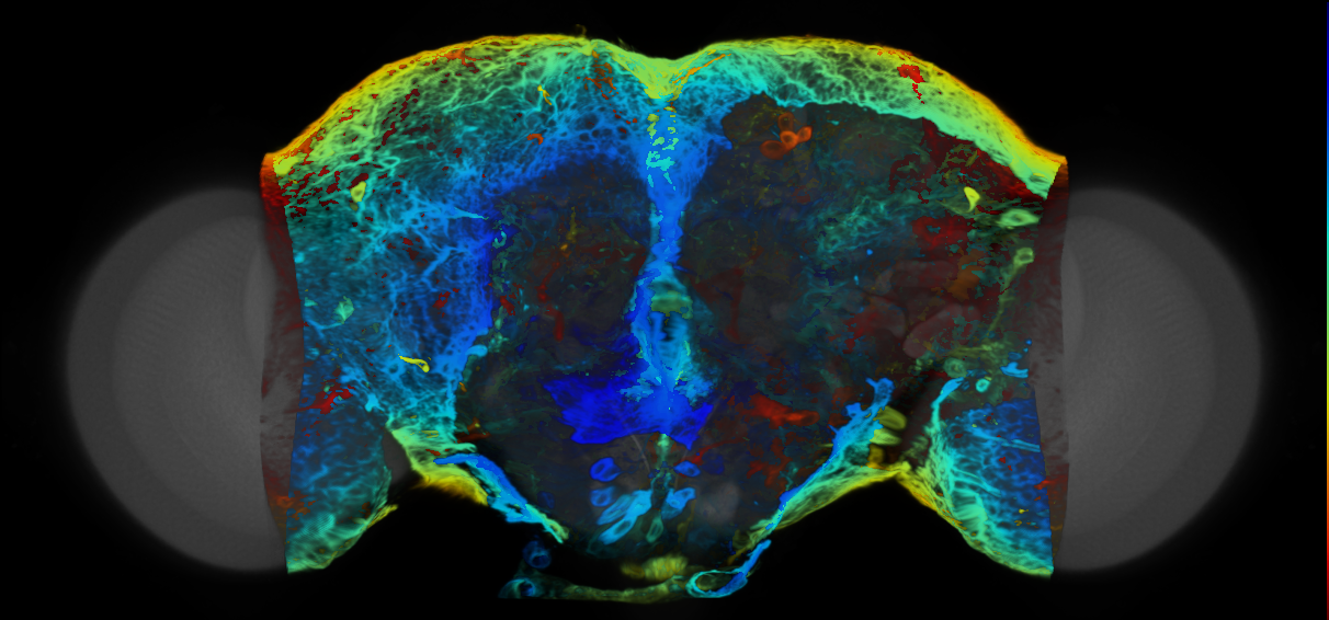 P{VT038885-GAL4} expression pattern
